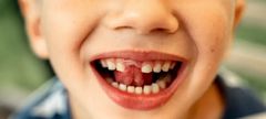 Dents des enfants : Les erreurs qui coûtent cher plus tard !