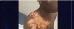 Touba : elle brûle son mari dans son sommeil, parce qu'il a voulu prendre une 2e épouse