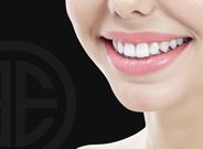 Vous voulez un sourire éclatant ? Testez ces méthodes