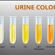 Why does your urine change colour? [Xcom]
