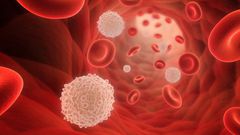 Leukaemia- Cancer Health
