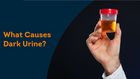 Why your urine looks darker in the morning [PristynCare]