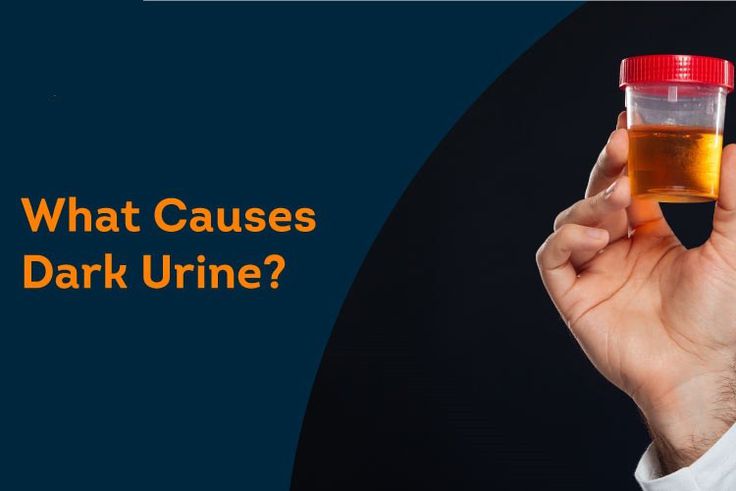 Why your urine looks darker in the morning [PristynCare]
