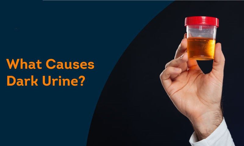 Why your urine looks darker in the morning [PristynCare]
