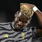 paul pogba controlé positif a la testosterone-