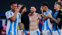 argentine