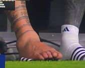 Blessure messi