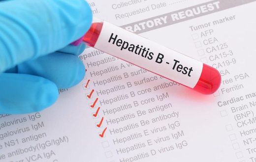 Test hepathite B