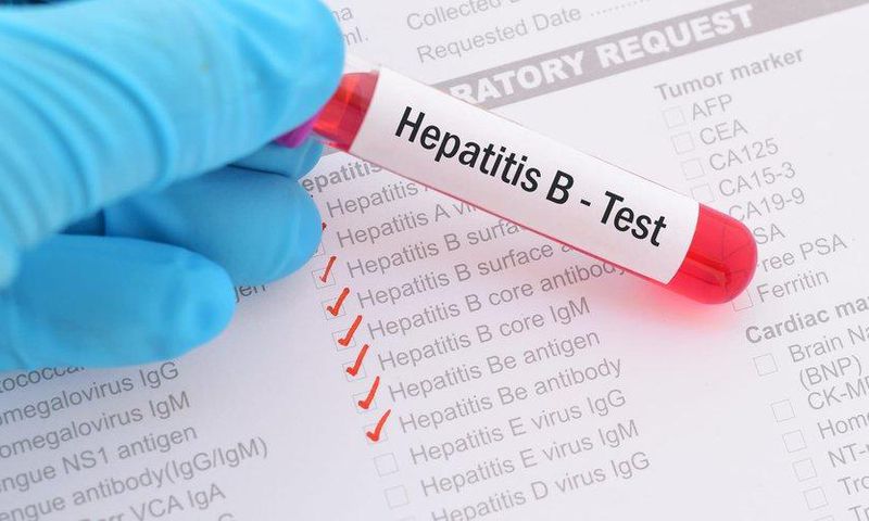 Test hepathite B