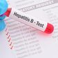 Test hepathite B