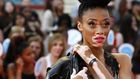 winnie-harlow