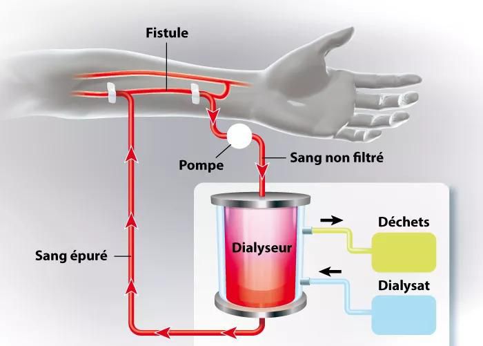 Néphrologie-Hémodialyse 2 jpg
