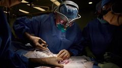Le rein d’un porc génétiquement modifié continue à fonctionner 32 jours après sa transplantation sur un humain en état de mort cérébrale. - Photo AFP