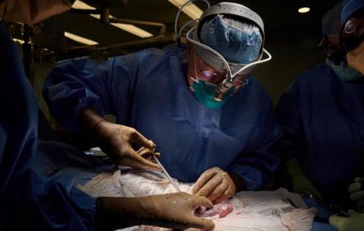 Le rein d’un porc génétiquement modifié continue à fonctionner 32 jours après sa transplantation sur un humain en état de mort cérébrale. - Photo AFP
