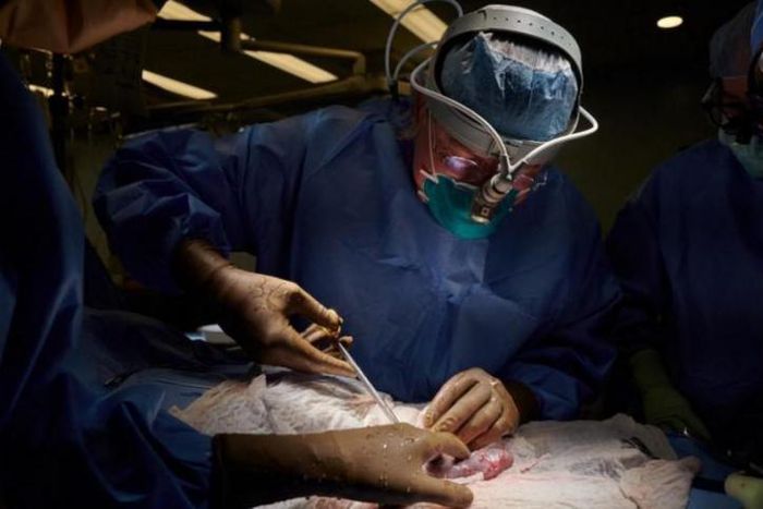 Le rein d’un porc génétiquement modifié continue à fonctionner 32 jours après sa transplantation sur un humain en état de mort cérébrale. - Photo AFP