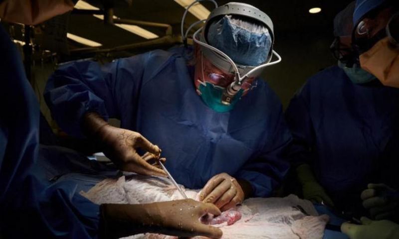 Le rein d’un porc génétiquement modifié continue à fonctionner 32 jours après sa transplantation sur un humain en état de mort cérébrale. - Photo AFP