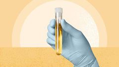 we-finally-know-why-pee-is-yellow-1440x810