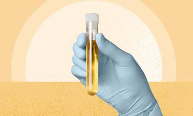 we-finally-know-why-pee-is-yellow-1440x810