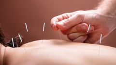 Acupunture  Andrey Popov - Fotoliacom