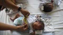 Bébé prématuré