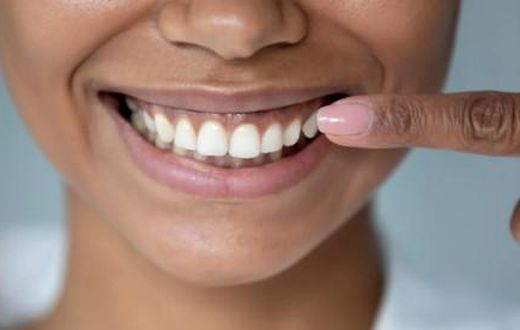 Dentition