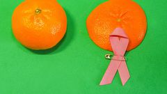 Breast Cancer Women who test positive for certain gene mutations or have a family history of breast cancer may choose to have a prophylactic mastectomy.japatino / Getty Images