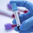 Test Coronavirus