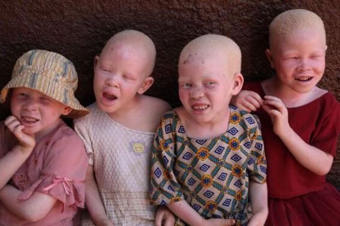 Albinos