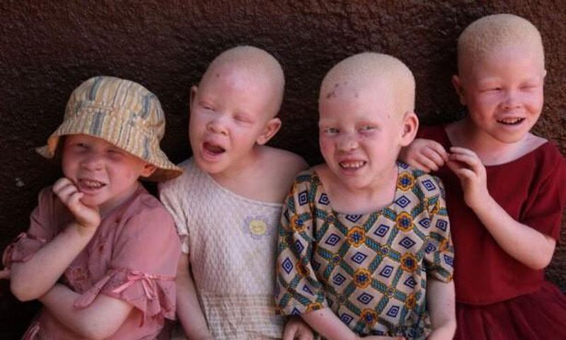 Albinos