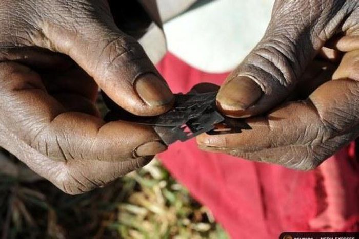 Au Sénégal, l'excision persiste avec un taux de 25%