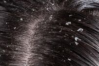pellicule