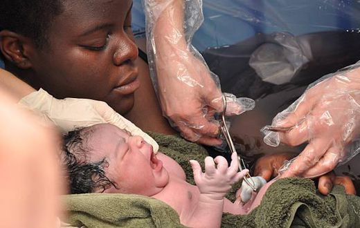 Facts about C-section [istock]