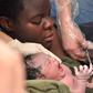 Facts about C-section [istock]