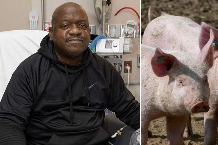 Le-premier-beneficiaire-du-rein-de-porc-genetiquement-modifie-est