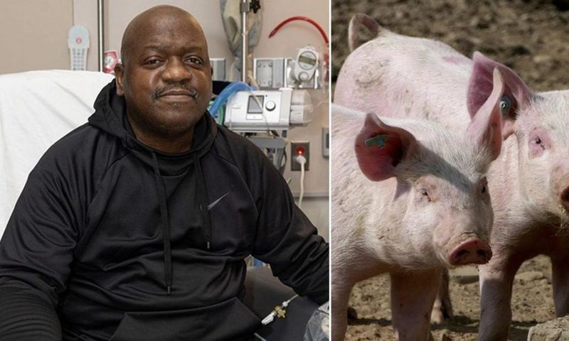 Le-premier-beneficiaire-du-rein-de-porc-genetiquement-modifie-est