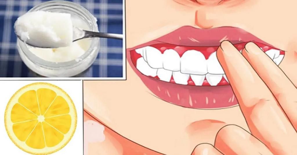 Astuce citron