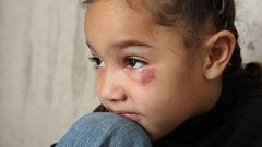 Unexplained physical injuries can be a sign [Studycom]