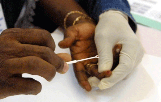 Drepanocytose-un-test-promet-d-ameliorer-le-depistage-de-cette-maladie-genetique-negligee