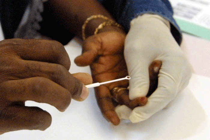 Drepanocytose-un-test-promet-d-ameliorer-le-depistage-de-cette-maladie-genetique-negligee