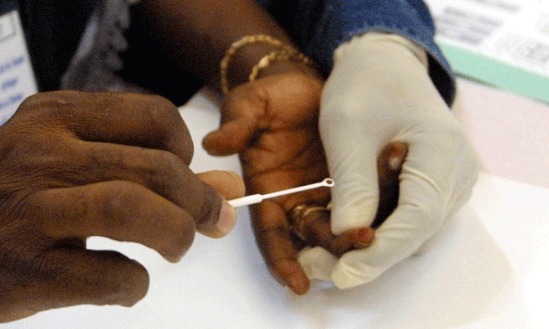 Drepanocytose-un-test-promet-d-ameliorer-le-depistage-de-cette-maladie-genetique-negligee