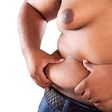 Obesity can lead to serious health problems if not addressed [iStock]