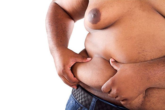 Obesity can lead to serious health problems if not addressed [iStock]