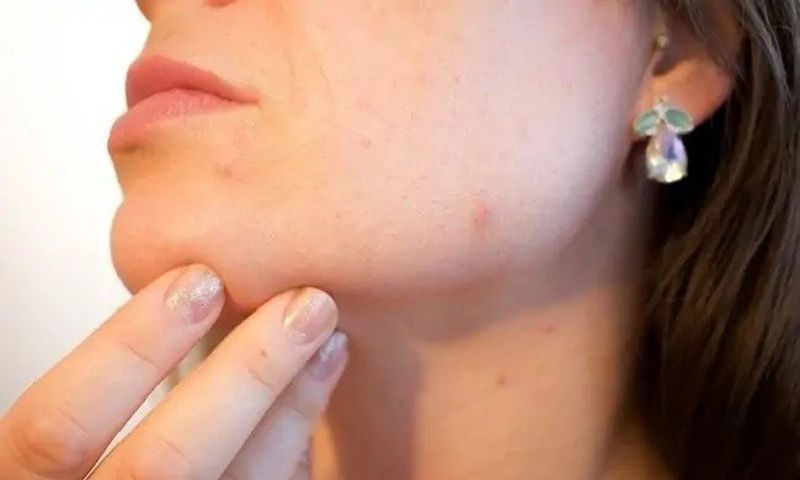 irritation-peau