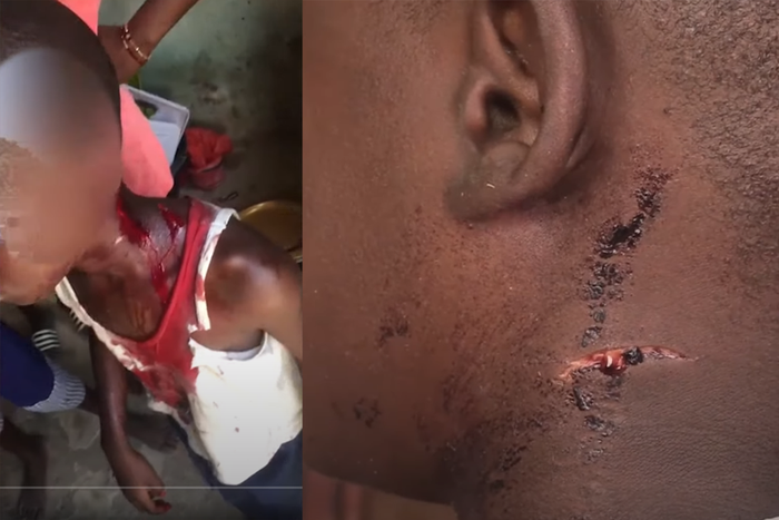 Thiès,-un-enfant-échappe-à-une-tentative-d'égorgement