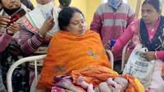 Inde - une femme accouche d'un enfant avec quatre bras et quatre jambes (1)