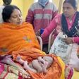 Inde - une femme accouche d'un enfant avec quatre bras et quatre jambes (1)