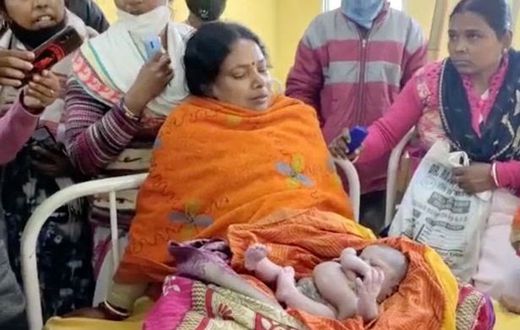 Inde - une femme accouche d'un enfant avec quatre bras et quatre jambes (1)
