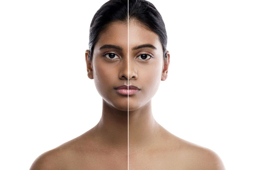 Products that lighten the skin are designed to reduce melanin [RxRejuvenate]