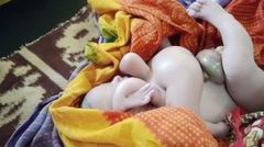 Inde - une femme accouche d'un enfant avec quatre bras et quatre jambes (3)