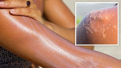 Astuces-pour-éviter-la-peau-qui-pèle